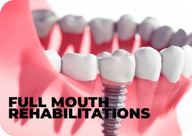 full mouth rehab.jpg